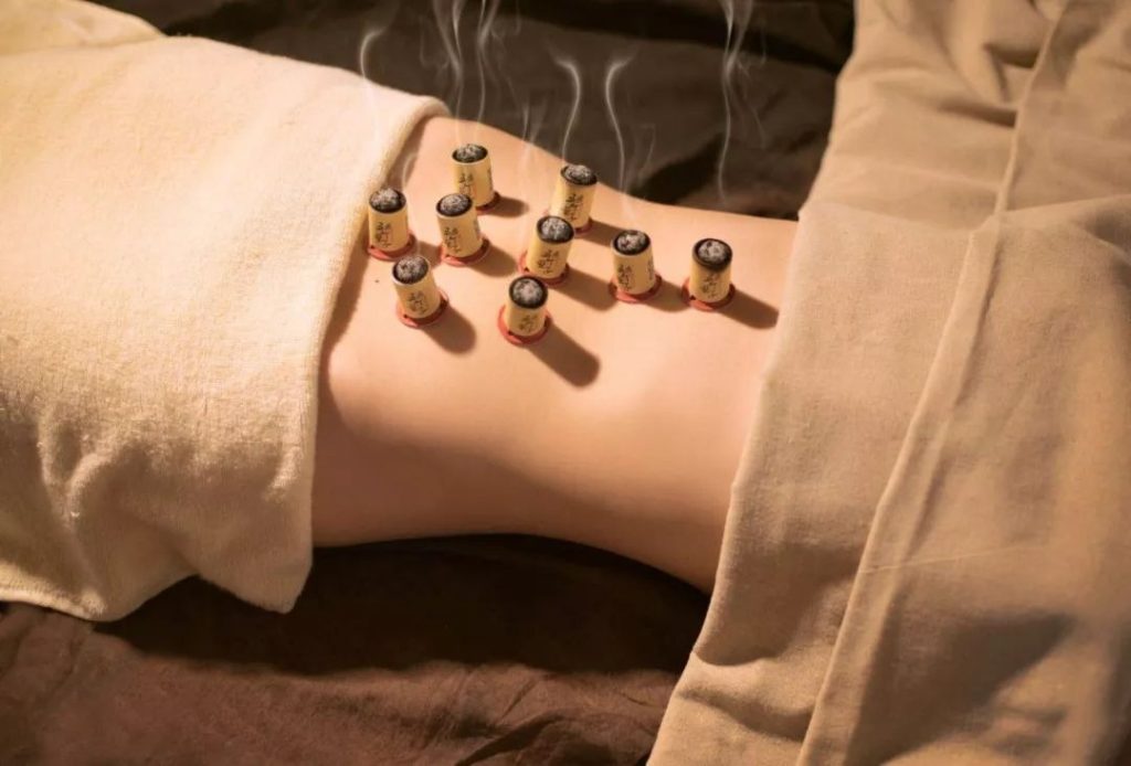 moxibustion