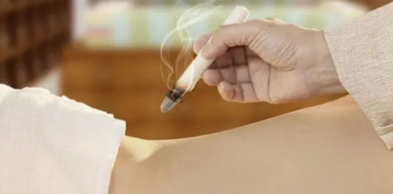 moxibustion