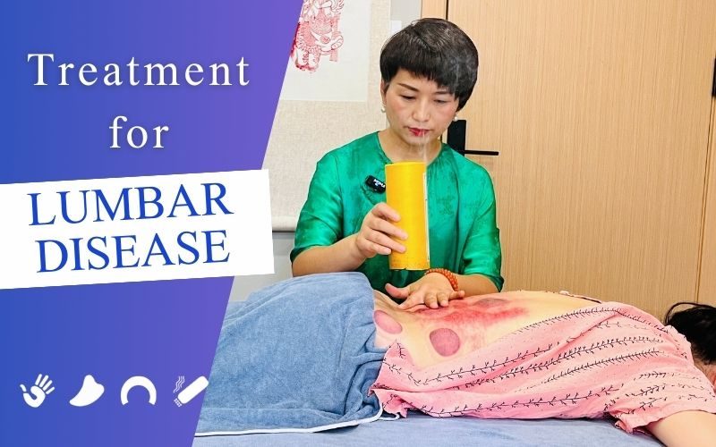 TCM External Treatments for Lumbar Disease