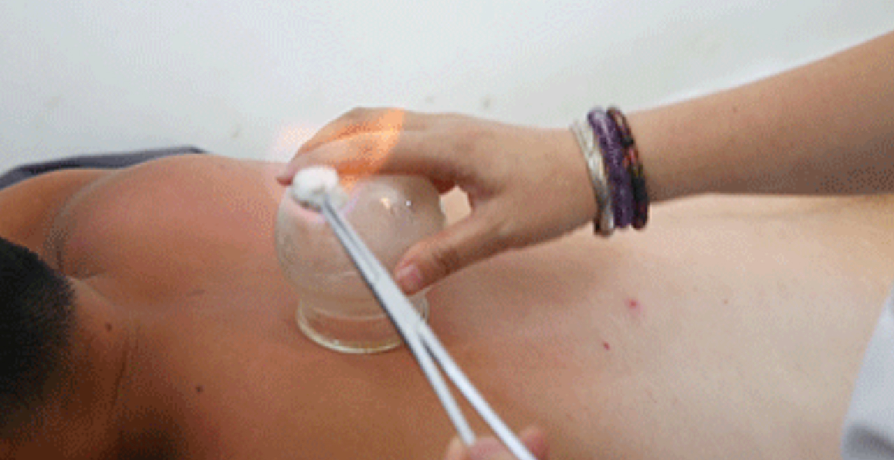 flash cupping