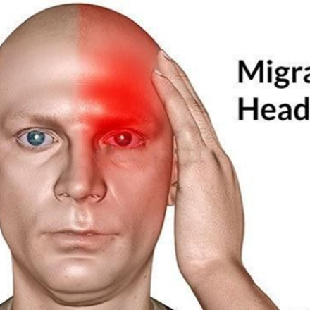 Can Acupressure Relieve Headaches?